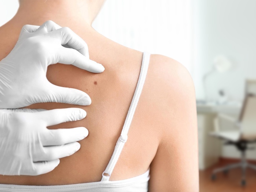 Kožní ambulance - MUDr. Andrea Cabrnochová